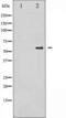 Cell Division Cycle 25A antibody, TA325327, Origene, Western Blot image 