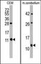 FKBP Prolyl Isomerase 1B antibody, AP14715PU-N, Origene, Western Blot image 