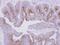 Microtubule Associated Protein 7 antibody, LS-C155637, Lifespan Biosciences, Immunohistochemistry paraffin image 