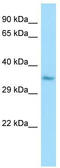 Malate dehydrogenase, cytoplasmic antibody, TA346602, Origene, Western Blot image 