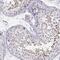 Kruppel Like Factor 17 antibody, PA5-55127, Invitrogen Antibodies, Immunohistochemistry paraffin image 
