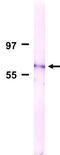 Nuclear pore glycoprotein p62 antibody, GTX00696, GeneTex, Western Blot image 
