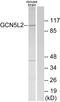 Histone acetyltransferase KAT2A antibody, A30540, Boster Biological Technology, Western Blot image 