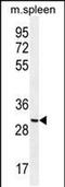 Coiled-Coil Domain Containing 84 antibody, PA5-48182, Invitrogen Antibodies, Western Blot image 