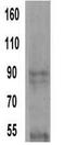 ACTN4 antibody, GTX15648, GeneTex, Western Blot image 