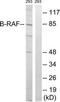 B-Raf Proto-Oncogene, Serine/Threonine Kinase antibody, TA326194, Origene, Western Blot image 