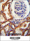 DnaJ Heat Shock Protein Family (Hsp40) Member C22 antibody, 55-481, ProSci, Immunohistochemistry frozen image 