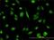 T-Complex 1 antibody, H00006950-M01, Novus Biologicals, Immunocytochemistry image 