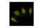 Keratin 18 antibody, 4546S, Cell Signaling Technology, Immunocytochemistry image 