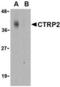 C1q And TNF Related 2 antibody, LS-C483, Lifespan Biosciences, Western Blot image 