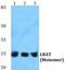Lecithin Retinol Acyltransferase antibody, PA5-36972, Invitrogen Antibodies, Western Blot image 