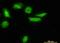 Low Density Lipoprotein Receptor Adaptor Protein 1 antibody, orb89784, Biorbyt, Immunocytochemistry image 