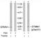 OP18 antibody, TA310080, Origene, Western Blot image 