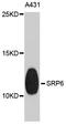 Signal Recognition Particle 9 antibody, A4124, ABclonal Technology, Western Blot image 