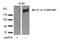ABL Proto-Oncogene 1, Non-Receptor Tyrosine Kinase antibody, P00133, Boster Biological Technology, Western Blot image 