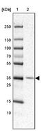 Ring Finger Protein 217 antibody, PA5-56203, Invitrogen Antibodies, Western Blot image 