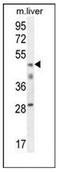 Core histone macro-H2A.2 antibody, AP51990PU-N, Origene, Western Blot image 