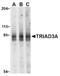 Ring Finger Protein 216 antibody, AP05247PU-N, Origene, Western Blot image 