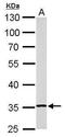 Ribosomal Protein L5 antibody, GTX101821, GeneTex, Western Blot image 