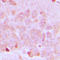 Solute Carrier Family 25 Member 21 antibody, LS-C353609, Lifespan Biosciences, Immunohistochemistry paraffin image 