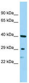 Suprabasin antibody, TA331355, Origene, Western Blot image 