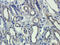 Receptor Tyrosine Kinase Like Orphan Receptor 2 antibody, orb191497, Biorbyt, Immunohistochemistry paraffin image 