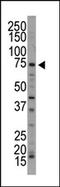 ARK5 antibody, AP15012PU-N, Origene, Western Blot image 