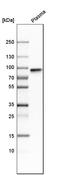 BM-90 antibody, HPA001612, Atlas Antibodies, Western Blot image 