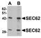 SEC62 Homolog, Preprotein Translocation Factor antibody, PA5-72702, Invitrogen Antibodies, Western Blot image 