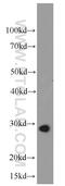 Mitochondrial uncoupling protein 2 antibody, 11081-1-AP, Proteintech Group, Western Blot image 