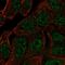 Ankyrin Repeat Domain 65 antibody, HPA065720, Atlas Antibodies, Immunofluorescence image 