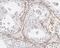 Zinc Finger Protein 174 antibody, FNab09661, FineTest, Immunohistochemistry paraffin image 