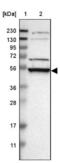 Ribosomal RNA processing protein 1 homolog A antibody, NBP1-85339, Novus Biologicals, Western Blot image 