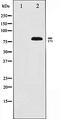 BMX Non-Receptor Tyrosine Kinase antibody, orb106456, Biorbyt, Western Blot image 