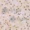 Small Nuclear Ribonucleoprotein Polypeptide E antibody, A5488, ABclonal Technology, Immunohistochemistry paraffin image 