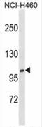 Xylosyltransferase 1 antibody, AP54591PU-N, Origene, Western Blot image 