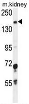 Immunoglobulin Superfamily Member 1 antibody, AP52175PU-N, Origene, Western Blot image 