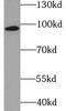 Muscle Associated Receptor Tyrosine Kinase antibody, FNab05442, FineTest, Western Blot image 