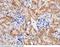 Carbonic Anhydrase 12 antibody, 50014-RP02, Sino Biological, Immunohistochemistry paraffin image 