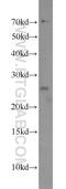 Small nuclear ribonucleoprotein-associated protein B antibody, 16807-1-AP, Proteintech Group, Western Blot image 