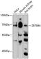 Zinc Finger And BTB Domain Containing 44 antibody, 14-817, ProSci, Western Blot image 