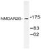 Glutamate Ionotropic Receptor NMDA Type Subunit 2B antibody, AP20498PU-N, Origene, Western Blot image 