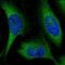 Kelch Like Family Member 28 antibody, HPA000988, Atlas Antibodies, Immunofluorescence image 