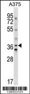 Arginine Vasopressin Receptor 1A antibody, 58-576, ProSci, Western Blot image 