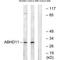 Abhydrolase Domain Containing 11 antibody, A11887, Boster Biological Technology, Western Blot image 