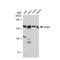 Drosha Ribonuclease III antibody, GTX09511, GeneTex, Western Blot image 