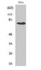 Solute Carrier Organic Anion Transporter Family Member 1A2 antibody, A05001, Boster Biological Technology, Western Blot image 