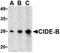 Cell Death Inducing DFFA Like Effector B antibody, orb74422, Biorbyt, Western Blot image 