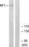 Neurofibromin 1 antibody, TA314247, Origene, Western Blot image 