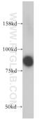 Lysine Acetyltransferase 7 antibody, 13751-1-AP, Proteintech Group, Western Blot image 
